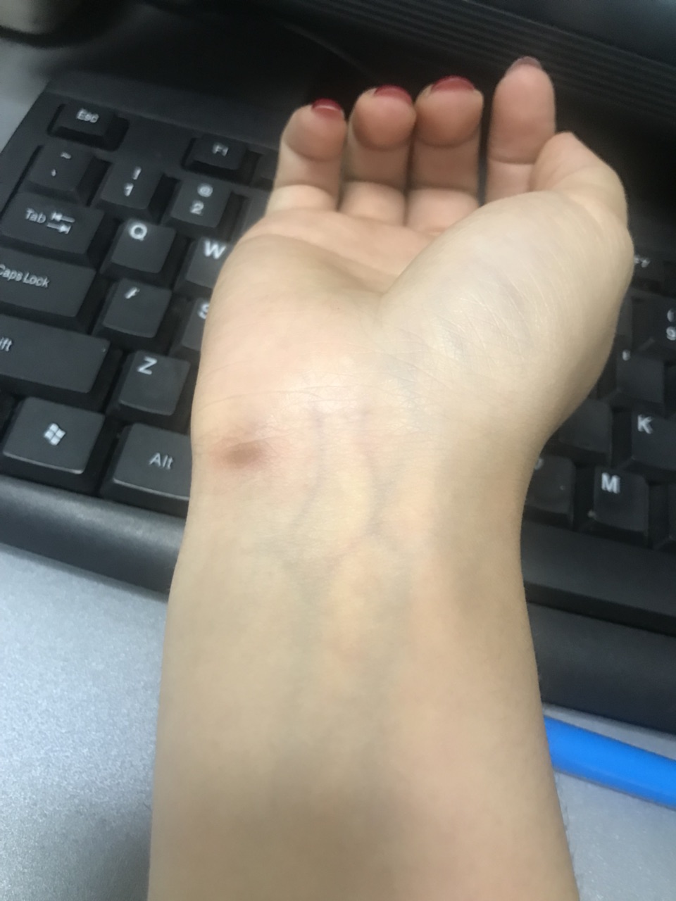 为什么手脖子这有黑的?